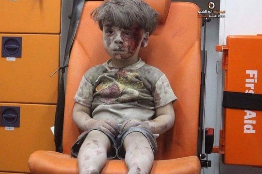 Omran Daqneesh (Foto: AMC)