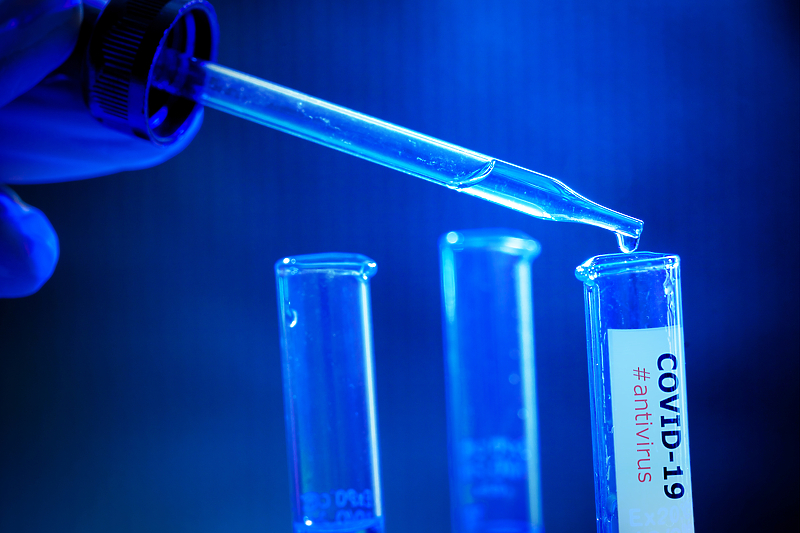 U Banjoj Luci od danas dostupno brzo antigensko testiranje na koronu (Ilustracija: Shutterstock)