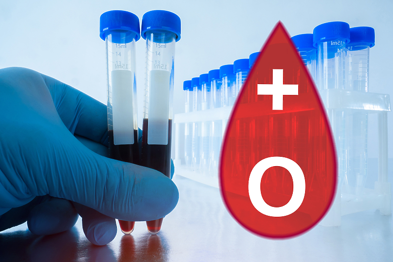 Zavodu potrebne zalihe 0+ krvne grupe (Ilustracija:Shutterstock)