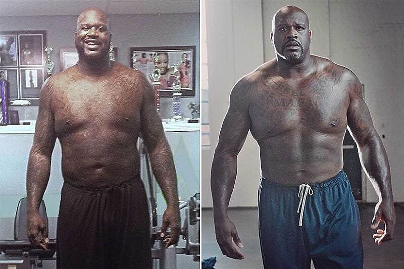 Shaquille O'Neal prije i sada (Foto:novexbiotech)