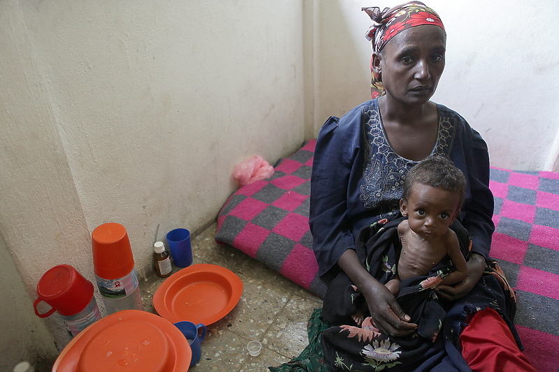 Etiopija među državama u kojima je glad posebno izražena (Foto: EPA-EFE)