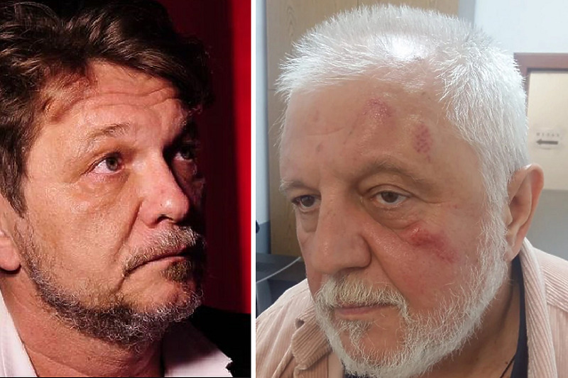 Dragan Bjelogrlić priveden zbog napada na Predraga Antonijevića, osumnjičen da ga je udarao u glavu
