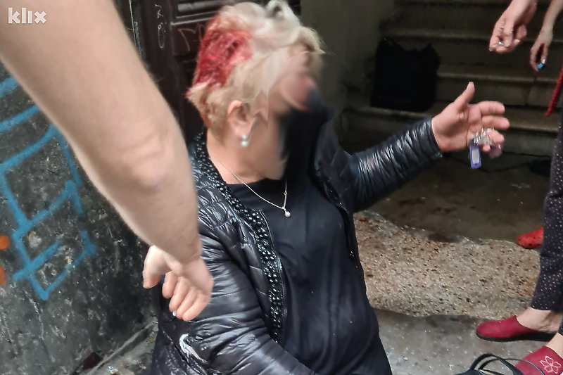 Žena je zadobila ugrize po glavi (Foto: Klix.ba)