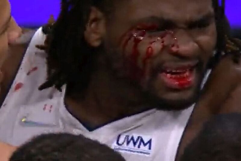 Lice Isaiha Stewarta bilo je krvavo nakon udarca koji je dobio od Jamesa (Foto: Twitter)