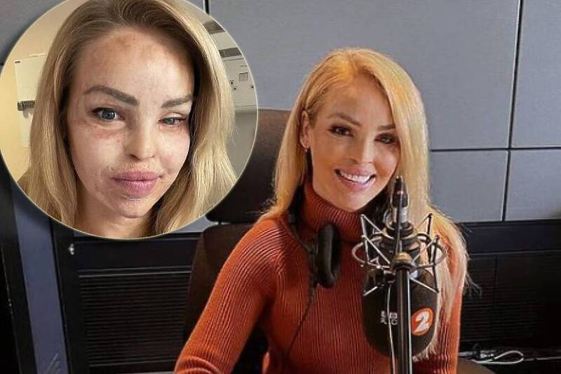 Katie Piper (Foto: Facebook)