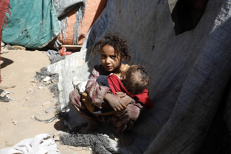 Rat u Jemenu traje sedam godina (Foto: EPA-EFE)