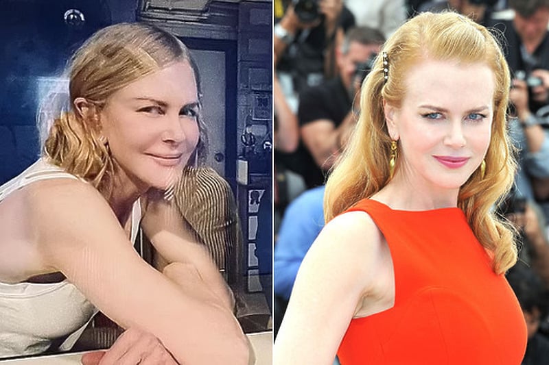 Nicole Kidman ponovo je iznenadila obožava