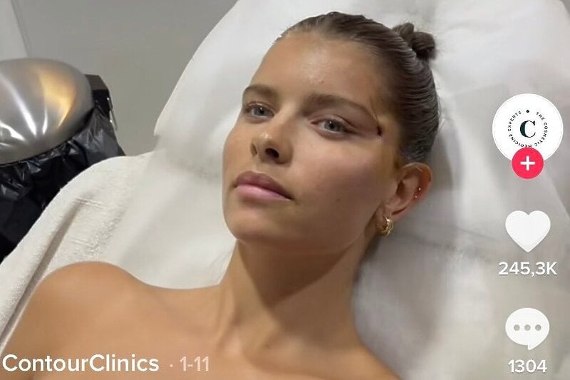 Screenshot: TikTok/countourclinics