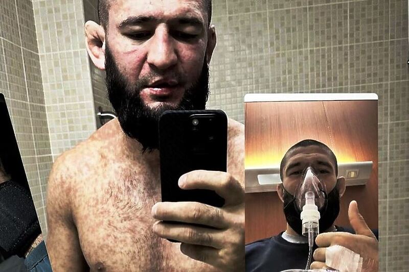 MMA borac izgledom zaprepastio fanove (Foto: Instagram)