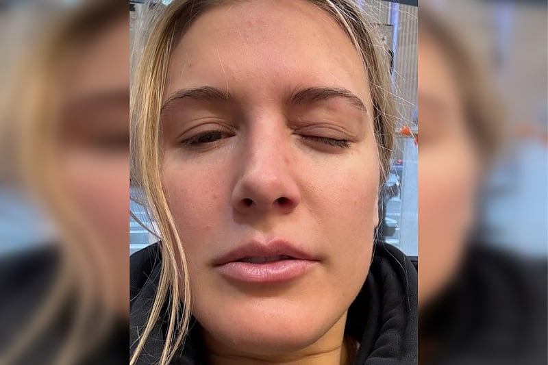 Eugenie Bouchard povrijeđena (Foto: Instagram)