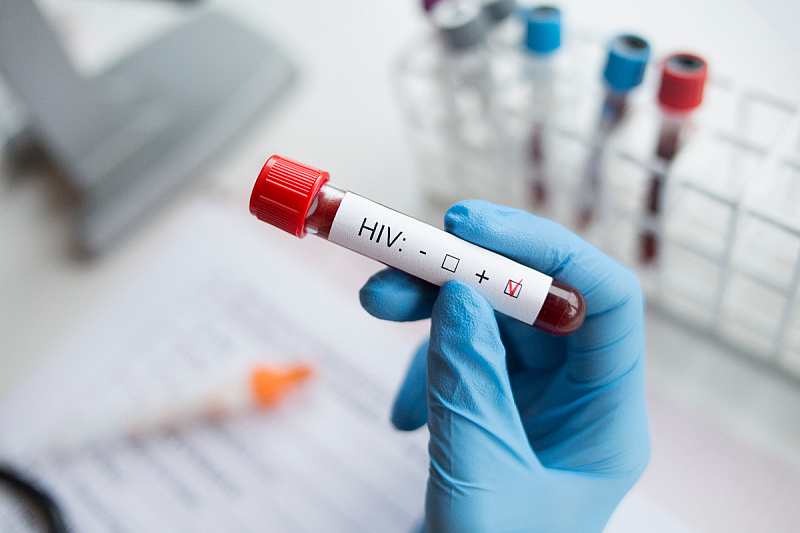 Procjenjuje se da je broj oboljelih tri puta veći, ali se mnogi ne testiraju (Foto: Shutterstock)