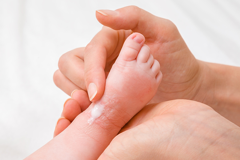 Foto: Shutterstock