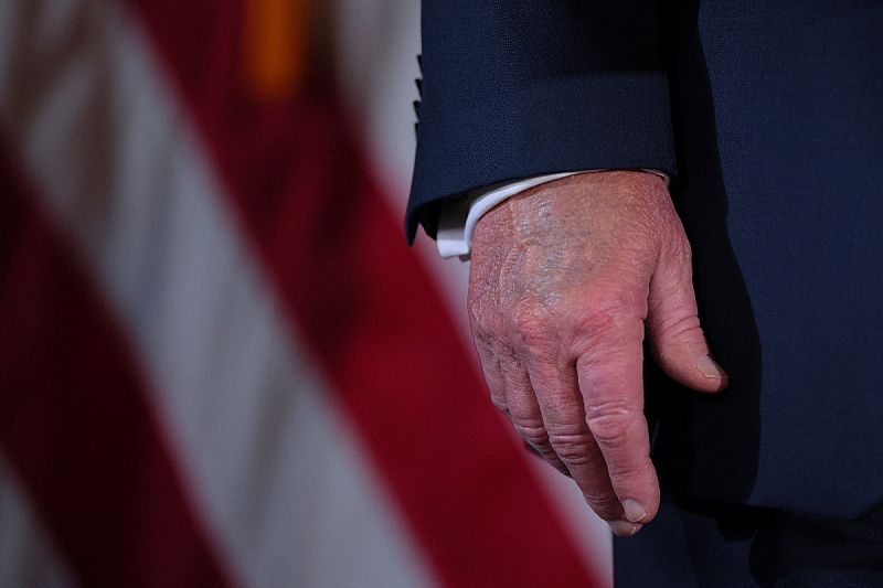 Oteklina u predjelu nadlanice Donalda Trumpa (Foto: Reuters)