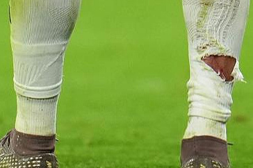 "How is this not a red card?": Referee forgave the start of Tahu that tore the studs and cut Mbappe's leg