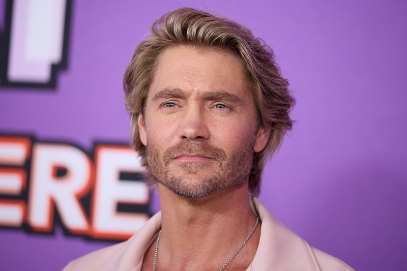 A photo of Chad Michael Murray before his nose injury has surfaced, and many are surprised by how different he looks.