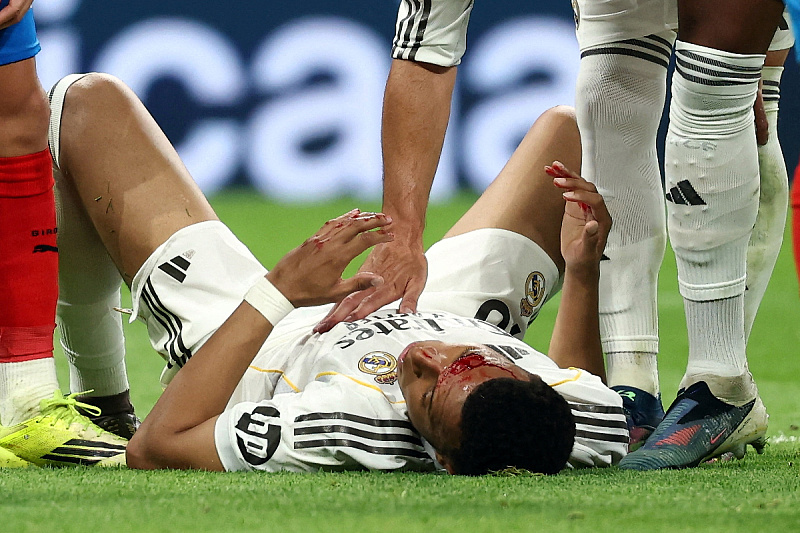 Injury for which Real Madrid did not get a penalty: See what photo Mbappe posted