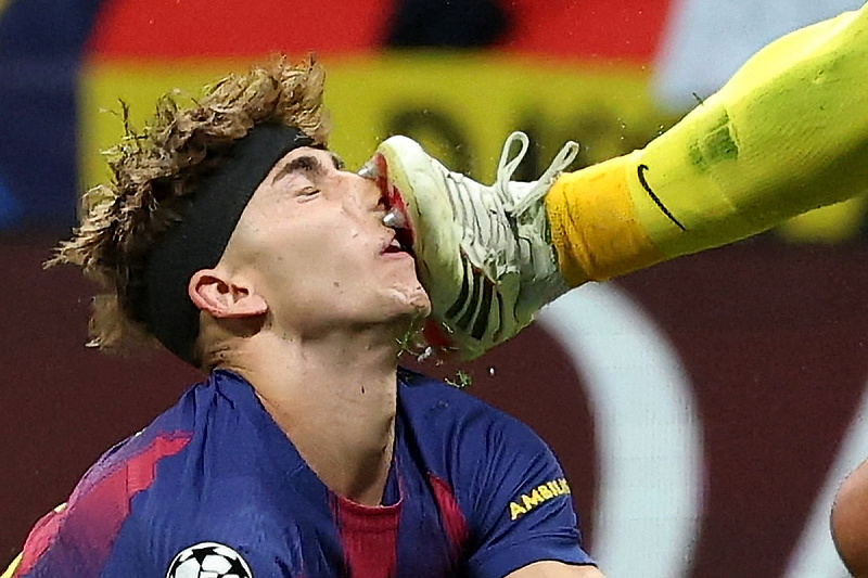 Watch the horrific start of Atletico's goalkeeper against Fermin, Barca's forward ended up all bloody.