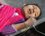 Čudo u Bangladešu: Žena preživjela 17 dana ispod ruševina