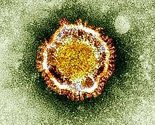 Novi virus prenosi se kontaktom, do sada umrlo više od 700 osoba