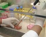 Virus MERS odnio prvu žrtvu u Kataru