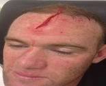 Rooney pokazao zašto propušta Moldaviju i Ukrajinu