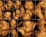 GuGu i Poliklinika Sunce – Agram poklanjaju 4D UZ pregled za trudnice
