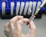Besplatna testiranja na HIV/AIDS u Banjoj Luci