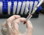 Porno industrija SAD-a ponovo pred zatvaranjem zbog HIV-a
