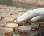 Hrvatska: Od superbakterije do sada oboljelo 17 osoba