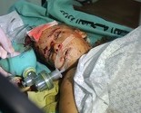 Gaza: Među 165 poginulih u izraelskim napadima, 33 djece i 16 žena