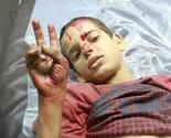 UNICEF: Gotovo 300 djece ubijeno u Gazi