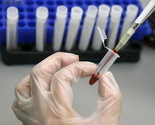 Banja Luka: Od ponedjeljka besplatno i anonimno testiranje na HIV