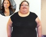Smršala 114 kilograma za godinu dana: Nije mogla disati, kretati se niti spavati