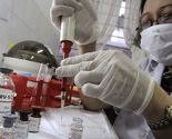 Evropska sedmica testiranja: Pričaj o HIV-u, testiraj se na HIV