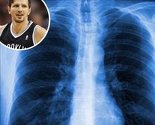 Dr. Čivić o bolesti Mirze Teletovića: Plućna embolija se liječi do šest mjeseci