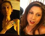 Rachael Farrokh: Od prelijepe glumice do anoreksične osobe koja se bori za život