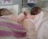 Dirljiva fotografija: Prerano rođene blizanke se drže za ruke u inkubatoru i bore se za život