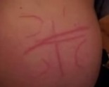 Urezali mu na tijelo "četiri S": Policija još uvijek traga za napadačima na povratnika Hanifića