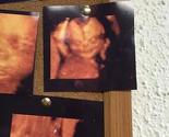 Fotografija bebe sa 4D ultrazvučnog pregleda iznenadila i preplašila roditelje