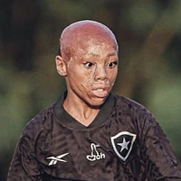 Nevjerovatna životna priča: Preživio stravičnu nesreću kao beba, a sada potpisao za brazilskog velikana