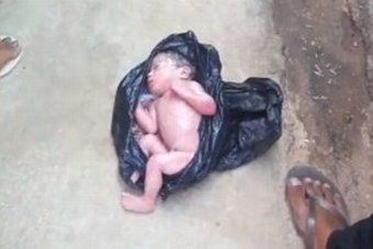 Bačeno poput smeća: Na Filipinima pronađena beba u plastičnoj kesi