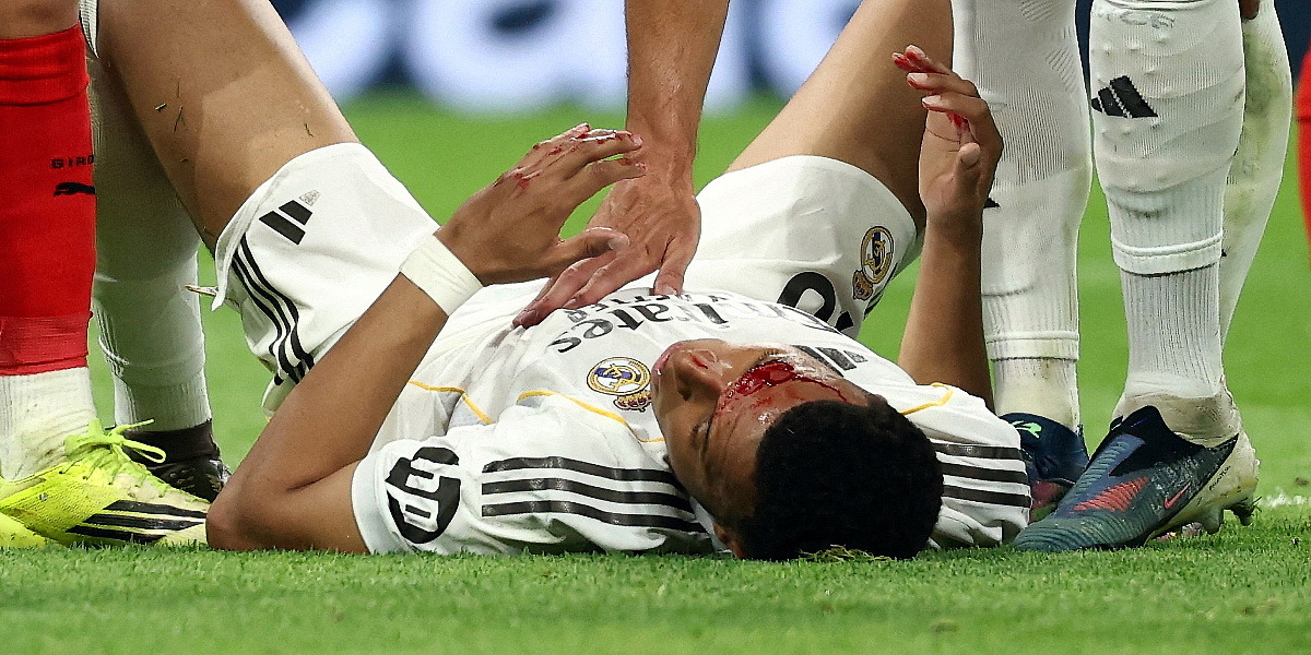 Povreda za koju Real nije dobio penal: Pogledajte kakvu je fotografiju objavio Mbappe