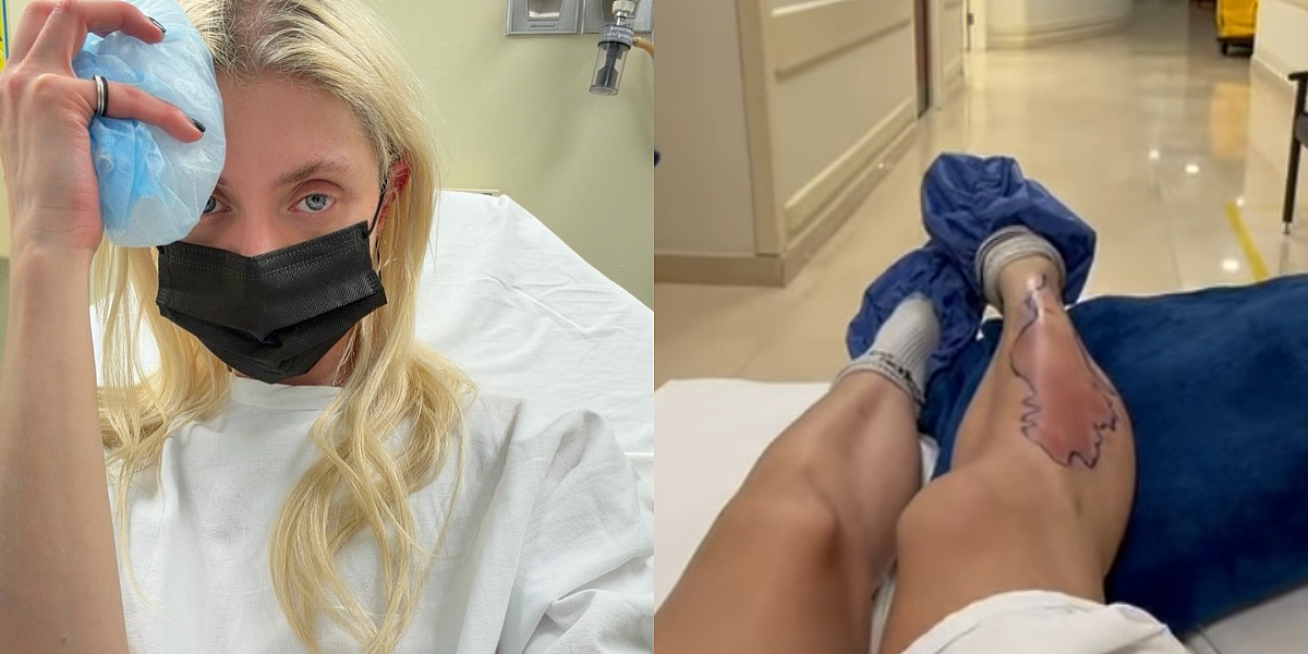 Američka pjevačica hospitalizirana nakon ugriza otrovnog pauka tokom turneje u Meksiku