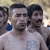 Migranti zašili svoja usta: Nezadovoljni odlukom o zatvaranju granica