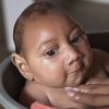 WHO: Očekuje se da će se Zika virus proširiti na cijelu Ameriku