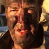 Jeremy Clarkson šokirao fanove "krvavim" selfijem: Preživio sam dan