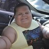 Dječak iz Brazila ima pet godina, a težak je čak 79 kilograma