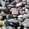 Turska: Iz tijela muškarca izvadili 82 kamenčića