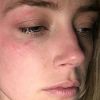 Amber Heard optužila Johnnyja Deppa za fizičko nasilje