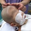 Zbog rijetkog poremećaja dječak izgledao kao vanzemaljac
